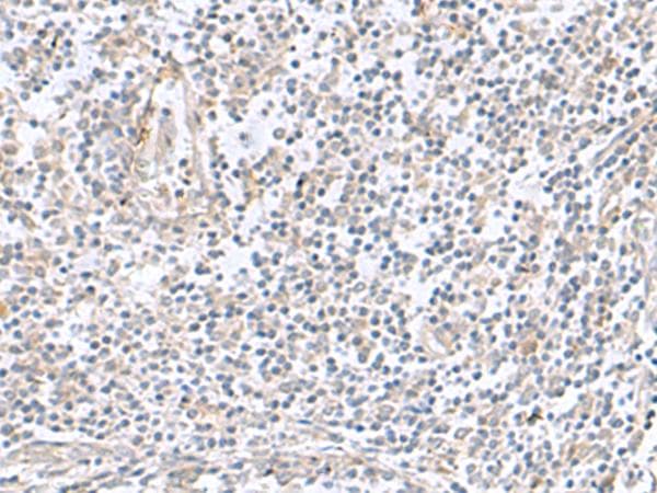 Polyclonal Rabbit anti-Human TNNC2 Antibody (IHC)