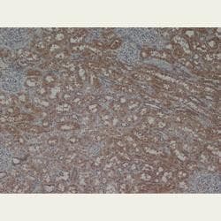 Laminin Antibody (Serum)