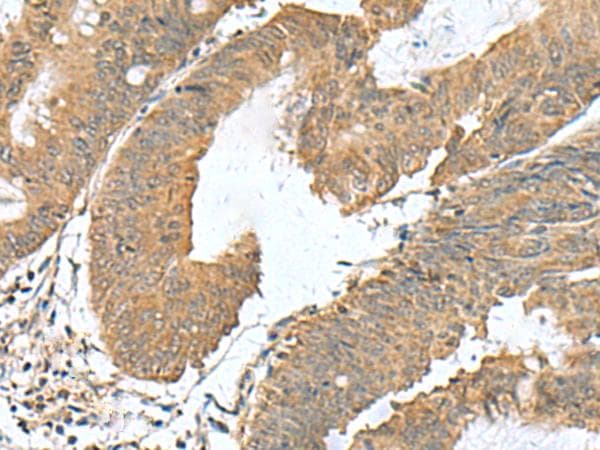 Polyclonal Rabbit anti-Human RAB23 Antibody (IHC)
