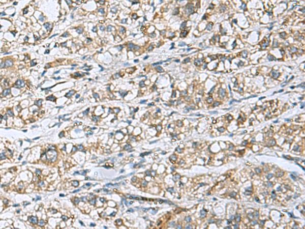 DNAJA4 Antibody