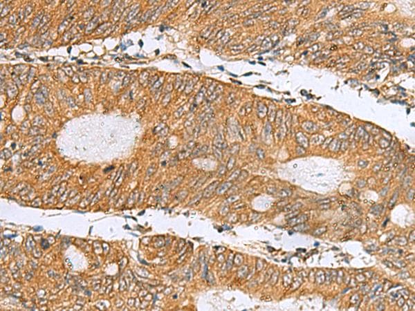 DNAJA4 Antibody