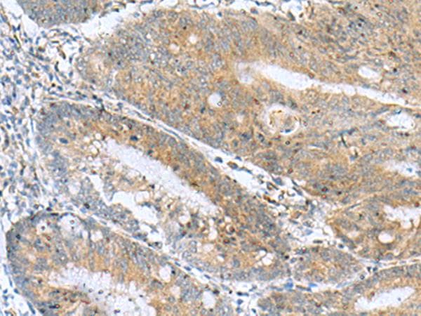 Polyclonal Rabbit anti-Human NANP Antibody (IHC)