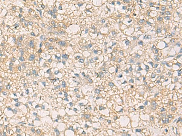 Polyclonal Rabbit anti-Human STX6 / Syntaxin 6 Antibody (IHC)