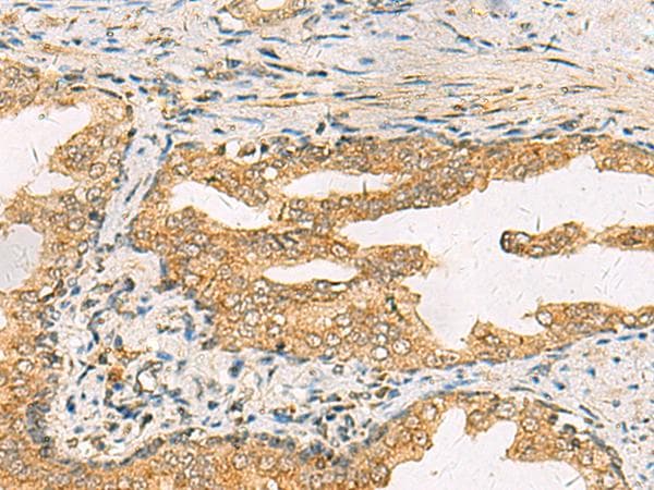 Polyclonal Rabbit anti-Human STX6 / Syntaxin 6 Antibody (IHC)