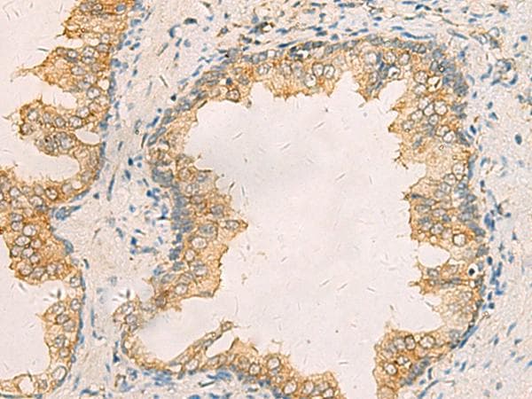 Polyclonal Rabbit anti-Human AIMP1 / EMAP II Antibody (IHC)