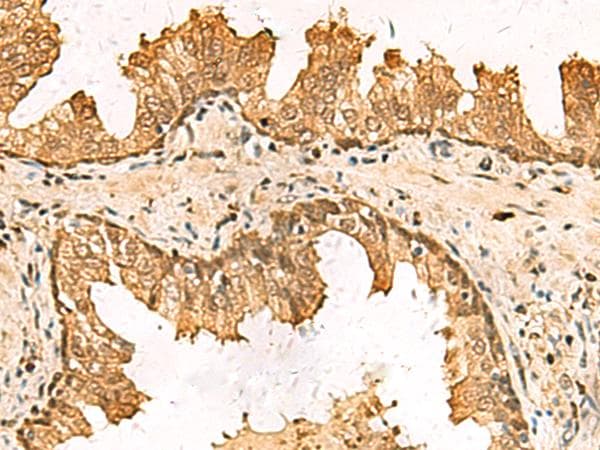 Polyclonal Rabbit anti-Human PDXK / PNK Antibody (IHC)