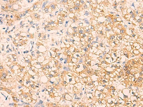 EPCAM Antibody