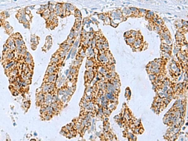 Polyclonal Rabbit anti-Human P5CR2 / PYCR2 Antibody (IHC)