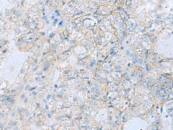 Polyclonal Rabbit anti-Human P5CR2 / PYCR2 Antibody (IHC)