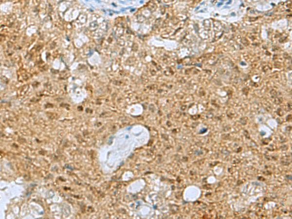 Polyclonal Rabbit anti-Human PPP2R4 Antibody (IHC)
