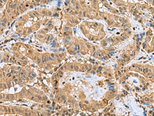 Polyclonal Rabbit anti-Human PPP2R4 Antibody (IHC)