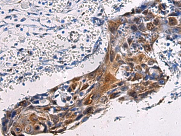 Polyclonal Rabbit anti-Human SORD / Sorbitol Dehydrogenase Antibody (IHC)