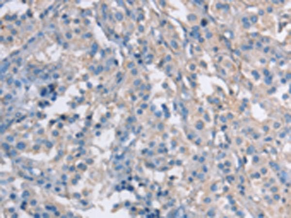 Polyclonal Rabbit anti-Human ZAP70 Antibody (IHC, WB)