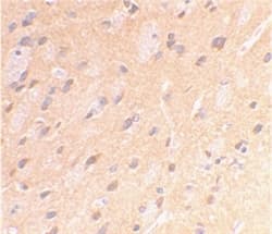 Polyclonal Rabbit APP / Beta Amyloid Precursor Antibody (C-Terminus, IHC, WB)