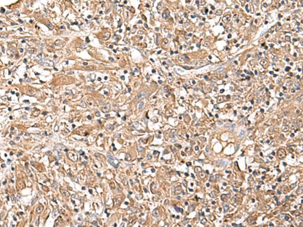 Polyclonal Rabbit anti-Human LEPR / Leptin Receptor Antibody (IHC, WB)