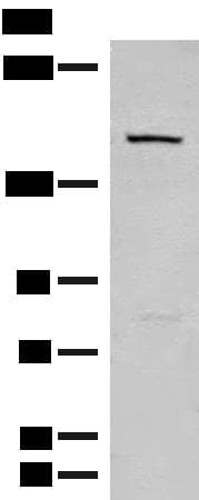 Polyclonal Rabbit anti-Human LEPR / Leptin Receptor Antibody (IHC, WB)