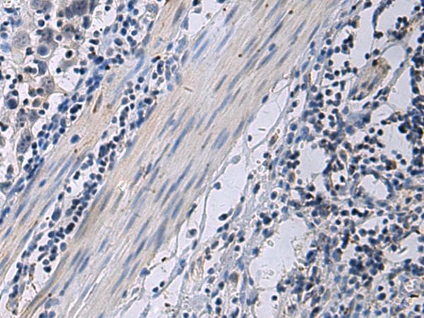 Polyclonal Rabbit anti-Human ANGPTL2 / ARP2 Antibody (IHC)