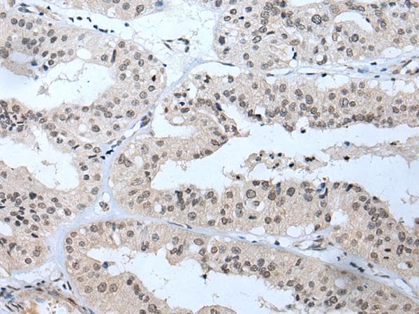Polyclonal Rabbit anti-Human TBX1 Antibody (IHC, WB)
