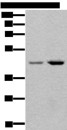 Polyclonal Rabbit anti-Human TBX1 Antibody (IHC, WB)