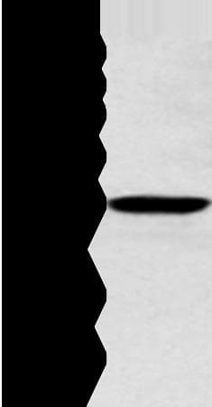 Polyclonal Rabbit anti-Human ALDH2 Antibody (WB)