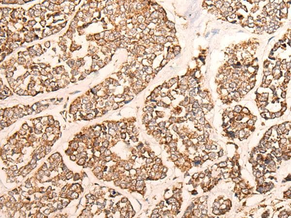 Polyclonal Rabbit anti-Human GRIA4 / GLUR4 Antibody (IHC)