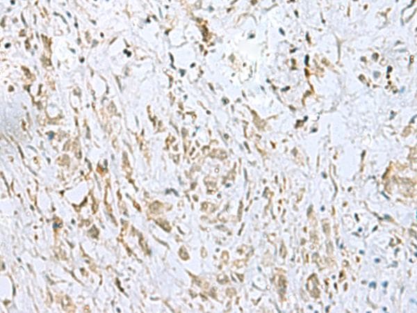 Polyclonal Rabbit anti-Human ECT2 Antibody (IHC)
