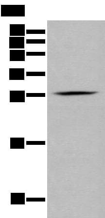 Polyclonal Rabbit anti-Human GZMM / Granzyme M Antibody (IHC, WB)