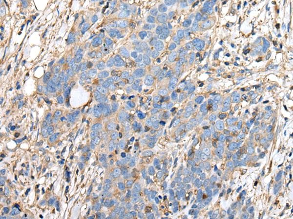Polyclonal Rabbit anti-Human PLA2G16 / HRASLS3 Antibody (IHC)