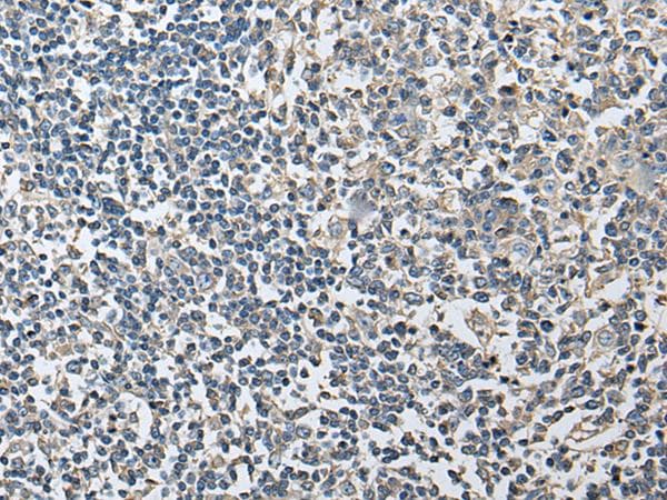 Polyclonal Rabbit anti-Human PLA2G16 / HRASLS3 Antibody (IHC)