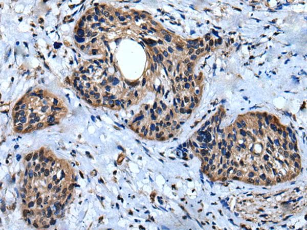 Polyclonal Rabbit anti-Human IQGAP1 Antibody (IHC, WB)
