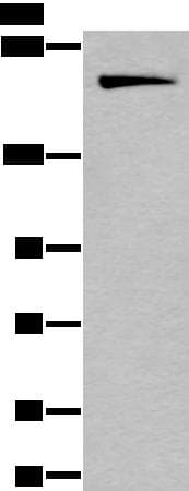Polyclonal Rabbit anti-Human IQGAP1 Antibody (IHC, WB)