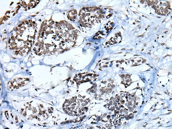 HIST1H3A Antibody