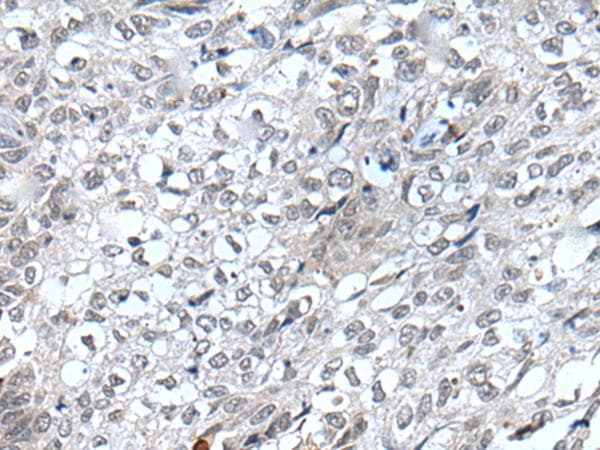 Polyclonal Rabbit anti-Human FLT4 / VEGFR3 Antibody (IHC)