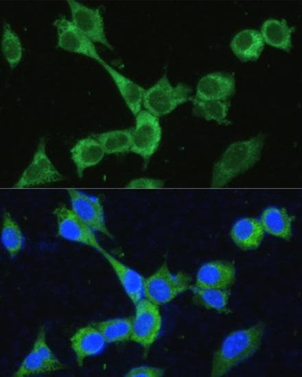 MTHFD2 Antibody