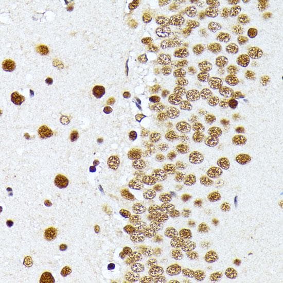 Polyclonal Rabbit anti-Human PRMT1 Antibody (IHC)