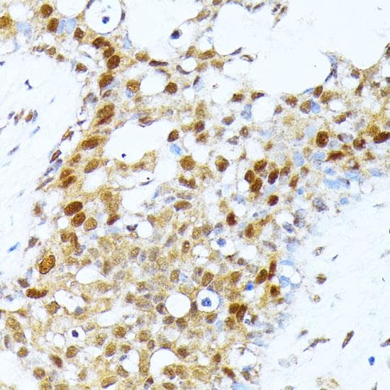 Polyclonal Rabbit anti-Human PRMT1 Antibody (IHC)