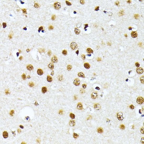 Polyclonal Rabbit anti-Human PRMT1 Antibody (IHC)