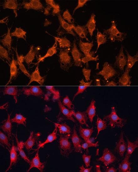 Polyclonal Rabbit anti-Human HSD17 / HSD17B1 Antibody (IHC, IF)