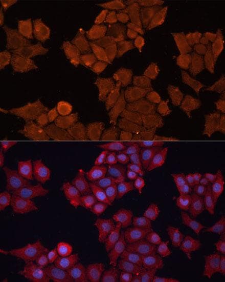 Polyclonal Rabbit anti-Human HSD17 / HSD17B1 Antibody (IHC, IF)