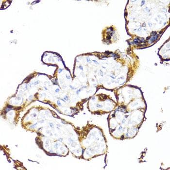 Polyclonal Rabbit anti-Human HSD17 / HSD17B1 Antibody (IHC, IF)