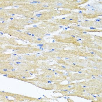Polyclonal Rabbit anti-Human HSD17 / HSD17B1 Antibody (IHC, IF)
