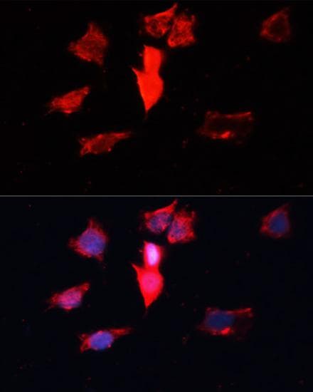 Polyclonal Rabbit anti-Human CALM1 / Calmodulin Antibody (IHC, IF, WB)