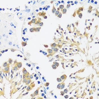 Polyclonal Rabbit anti-Human CALM1 / Calmodulin Antibody (IHC, IF, WB)