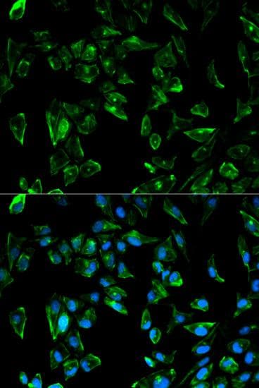 Polyclonal Rabbit anti-Human TPM3 Antibody (IF, WB)