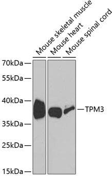 Polyclonal Rabbit anti-Human TPM3 Antibody (IF, WB)