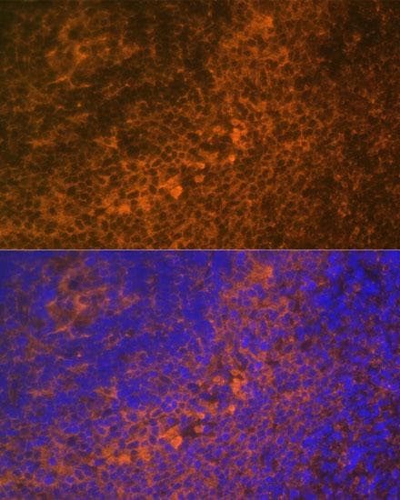Polyclonal Rabbit anti-Human TNFRSF10A / DR4 Antibody (IF)