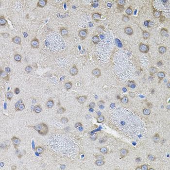 Polyclonal Rabbit anti-Human IKBKG / NEMO / IKK Gamma Antibody (IHC)