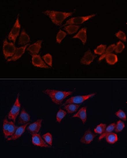 Polyclonal Rabbit anti-Human HMOX1 / HO-1 Antibody (IHC, IF)