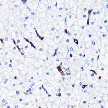 Polyclonal Rabbit anti-Human HMOX1 / HO-1 Antibody (IHC, IF)