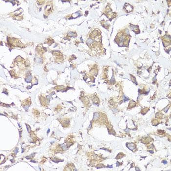 VTN / Vitronectin Antibody